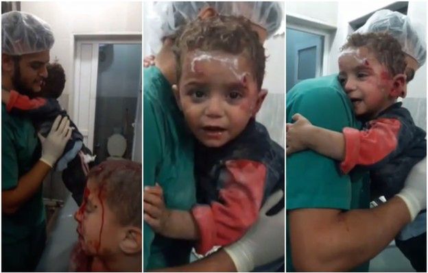 Wstrząsające nagranie syryjskiego chłopca, który w szoku po bombardowaniu wtula się w pielęgniarza