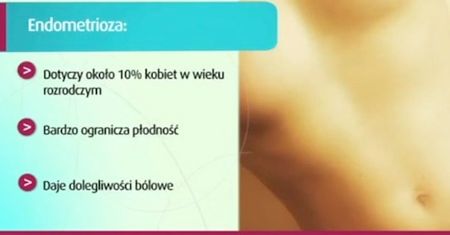 Czym jest endometrioza?