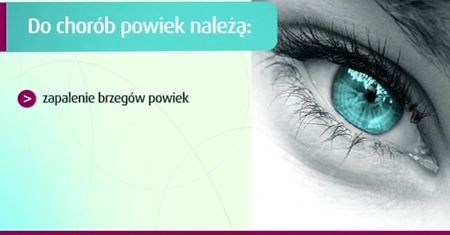 Choroby brzegów powiek