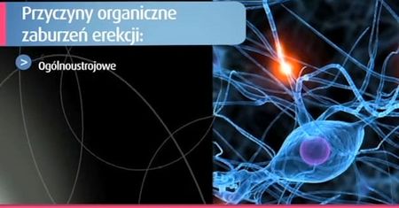 Leczenie zaburzeń organicznych (WIDEO)