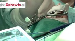 Co to są implanty podniebienne?