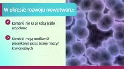 Od czego zależą przerzuty w raku żołądka?