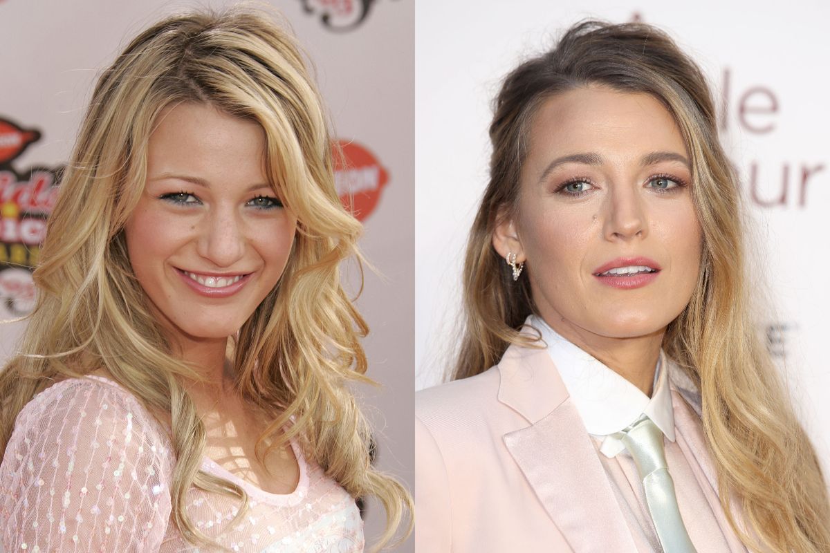 Blake Lively przed operacją nosa i po niej 
