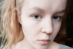 Lekarze i rodzice "pozwolili odejść" nastolatce w Holandii. To nie była eutanazja