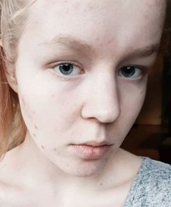 Lekarze i rodzice "pozwolili odejść" nastolatce w Holandii. To nie była eutanazja