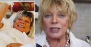 Dorota Stalińska pokazała efekt operacji. Zdjęcie ze szpitala obiegło sieć i wystraszyło fanów. "Czy te palce bolą?"
