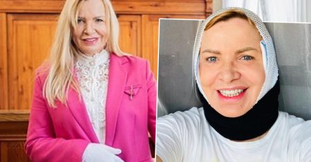 Ewa Sitarz z "Sanatorium Miłości" po odważnym zabiegu. Może zaboleć od samego patrzenia. Tylko u nas zdjęcia!