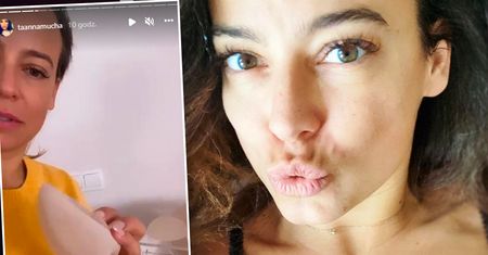 Anna Mucha poszła do kliniki medycyny estetycznej! Po wszystkim pokazała zdjęcie wielkiego biustu!