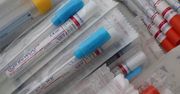 70 proc. próbek przesiewowych zakażonych angielską mutacją koronawirusa w Olsztynie