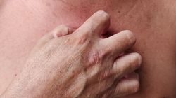 Znak, że pasożyty gnieżdżą się w twoim ciele. Nie lekceważ