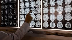 Zbadali mózgi ''superstulatków". Odkryli sekret długowieczności?