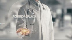 Achondroplazja - objawy, przyczyny, leczenie