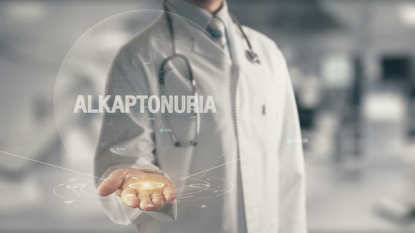 Alkaptonuria to wrodzona choroba metaboliczna