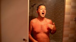 Objaw widać gołym okiem. Znak, że wątroba jest na wykończeniu