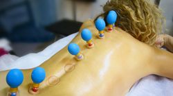 Stawianie baniek - wskazania i przeciwwskazania. Jak stawiać bańki?