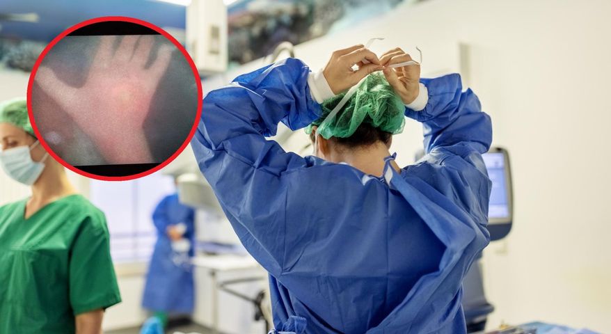 Podczas fetoskopii jedno z dzieci pomachało do kamery