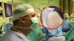 To już prawdziwa plaga. Do lekarzy trafia coraz więcej Polek z gigantycznymi guzami