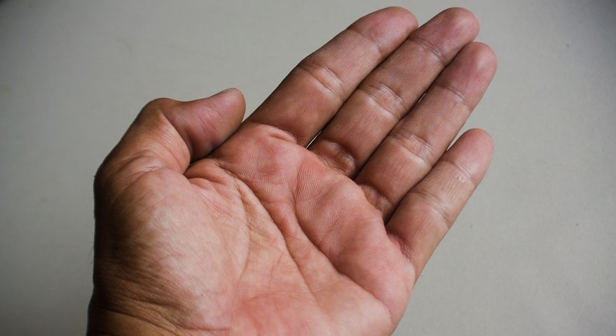 Jak rozpoznać wątrobowe dłonie? To ważny sygnał alarmowy