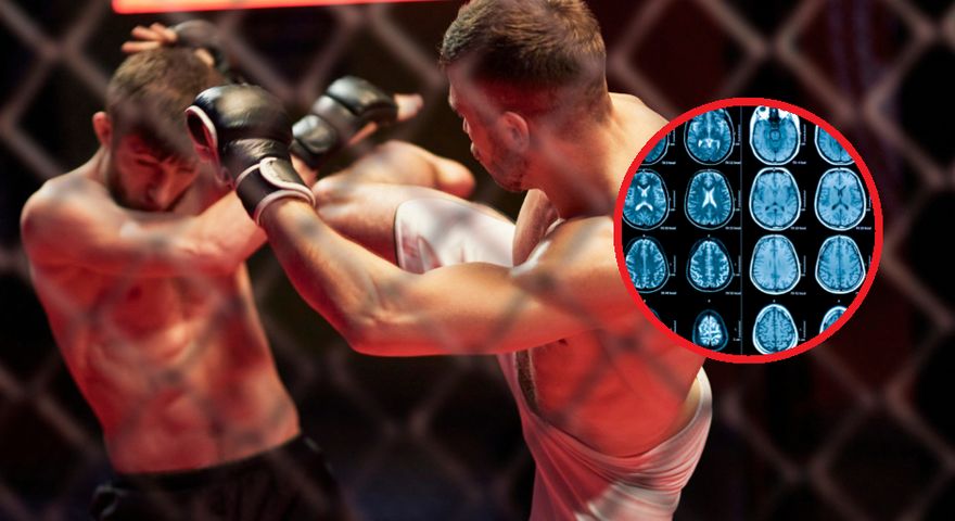Przewlekła encefalopatia pourazowa nie jest tylko problemem bokserów