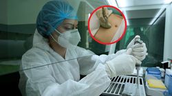 Główny sprawca raka żołądka. "Aż 80 procent przypadków "