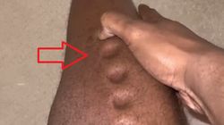 Ciało znanego sportowca było jak plastelina. Tak dała o sobie znać groźna choroba