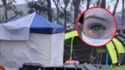 Wyjazd z rodziną zakończył się tragicznie. Jej oko zmieniło kolor