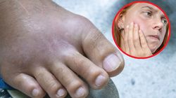 Tego się nie spodziewasz. Naukowcy odkryli, jak uniknąć zapalenia stawów