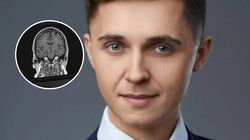 Mówi o nim cały świat. Mateusz Hołda odkrył przyczynę udaru