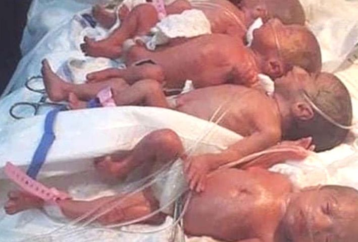 Los nueve gemelos sorprendieron a los médicos.  Así es como se ve hoy