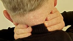 Już zabija 1,7 mln ludzi rocznie. "Niestety rysuje się czarny scenariusz"