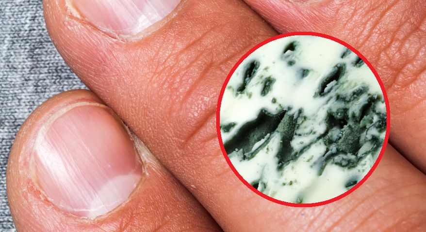 Wygląd paznokci może powiedzieć o kondycji naszego zdrowia znacznie więcej, niż przypuszczamy.
