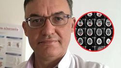 Niepokojące zjawisko. Oto co neurolog zauważa teraz u zakażonych