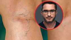 Groźny czynnik zwiększający ryzyko zakrzepicy. Tak się go pozbędziesz