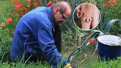 Wystarczy banalne skaleczenie. "Choroba jest straszna"