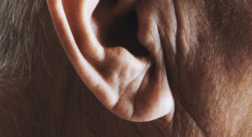 Naukowcy wykazali związek między obecnością fałdy na płatku ucha a zwiększonym ryzykiem miażdżycy