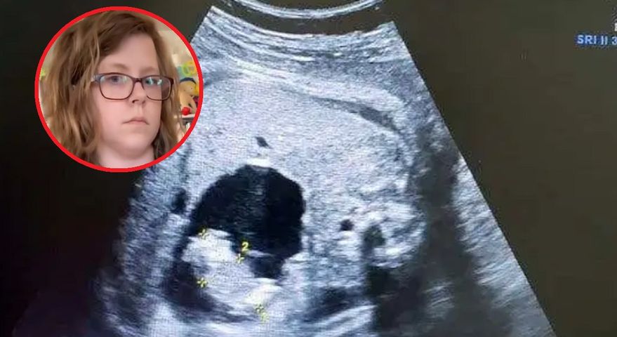 Urodziła dwie pary bliźniąt i ponownie zaszła w ciążę