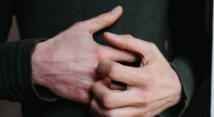 Swędzenie czy guzy pod skórą - może to świadczyć o poważnej chorobie.