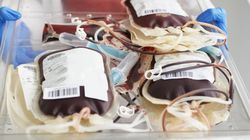 Pozytywnie wpływa na krew i zmienia jej skład. Ważna jest regularność 