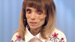 Kiedyś ważyła tylko 17 kg i była blisko śmierci. Dzisiaj jest nie do poznania