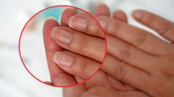 Wykańcza mózgi Polaków. Pierwsze objawy zobaczysz na paznokciach