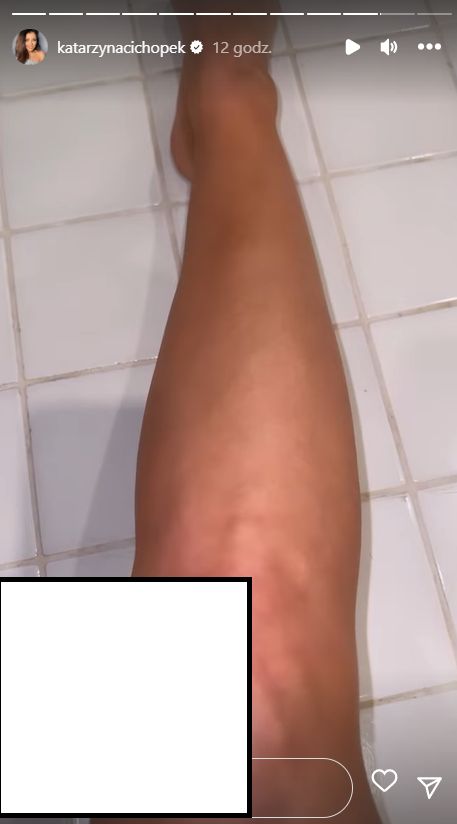 Czemu Kasia Cichopek zawdzięcza opaleniznę?