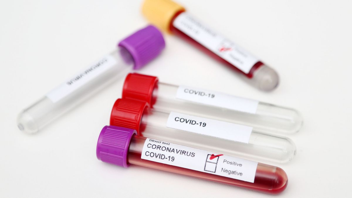 Testy na koronawirusa to zdecydowanie jedna z najbardziej pożądanych w naszym kraju rzeczy