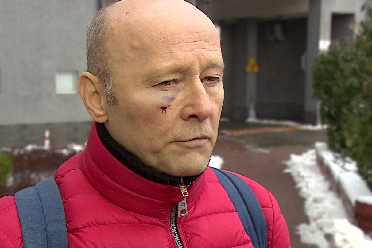 Aktor tłumaczy, że próbował się bronić