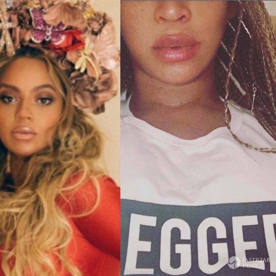 Beyonce powiększyła usta?