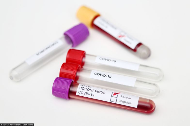 Testy na koronawirusa to zdecydowanie jedna z najbardziej pożądanych w naszym kraju rzeczy