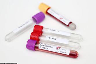 Polska firma podaruje szpitalom 100 tys. testów na koronawirusa. Ma tylko jedną prośbę do urzędników