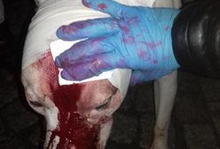 Wałbrzych. Amstaff rzucił się na dziecko. Już wcześniej zaatakował chłopca