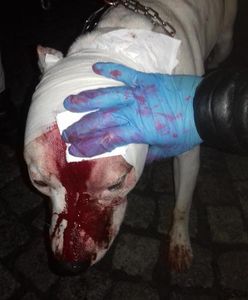 Wałbrzych. Amstaff rzucił się na dziecko. Już wcześniej zaatakował chłopca