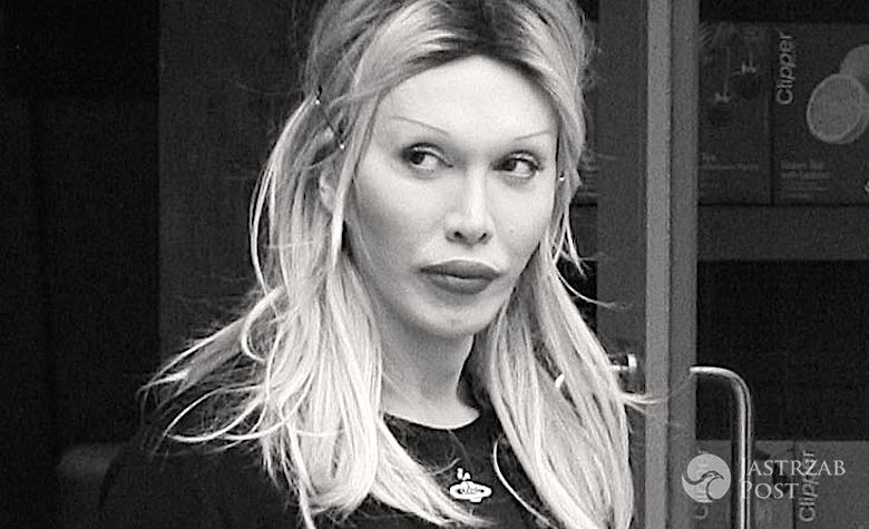 Pete Burns nie żyje