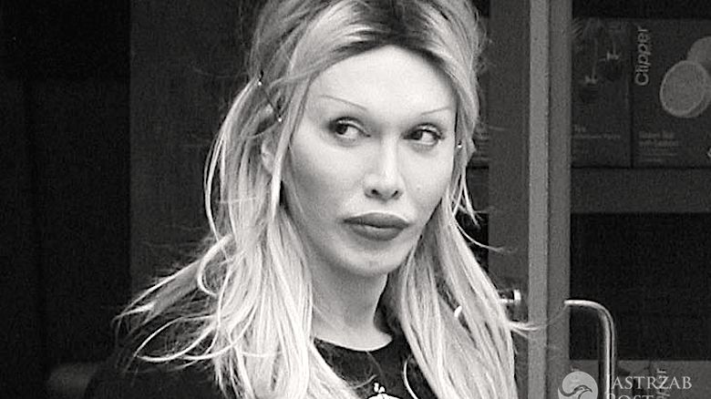 Pete Burns nie żyje